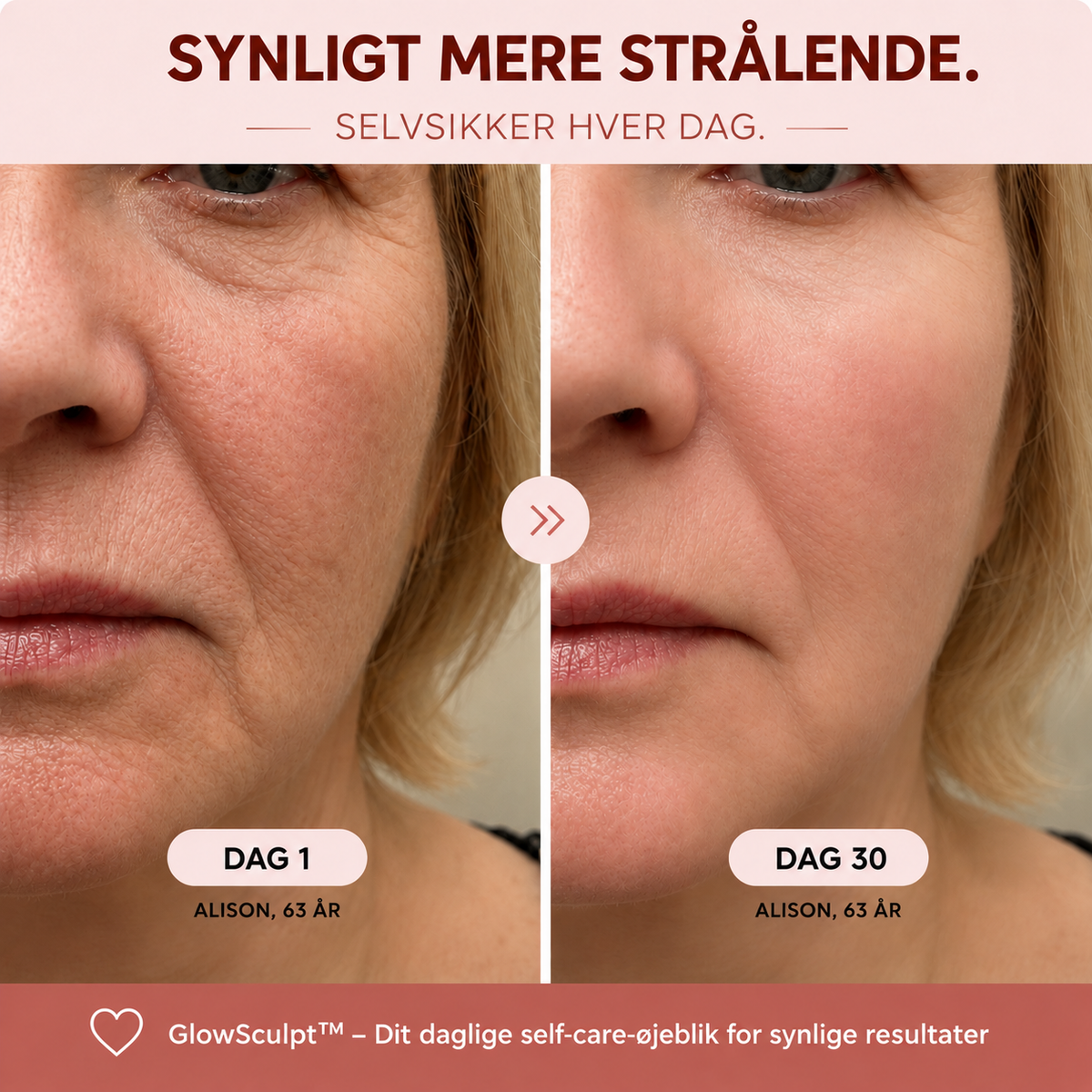 GlowSculpt™ LED-ansigts- & halsplejer – For et friskere, mere løftet look.